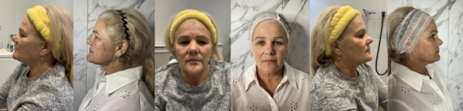 Amazing Results from their Patients 