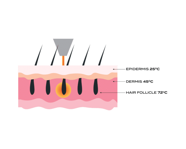 More than a diode. A premium diode platform.